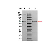 AKT2 Human Recombinant Protein, 10µg