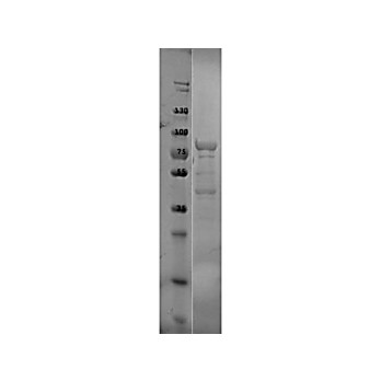 p39 Control Protein, 100µg