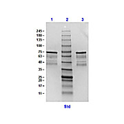 Surface Lipoprotein p27 Control Protein, 100µg