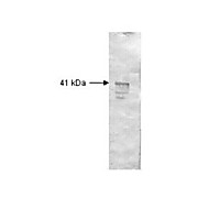 Anti-DEXTRANASE (Penicillium species) (RABBIT) Antibody, 2mL, Lyophilized