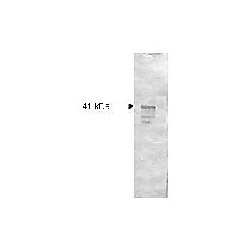 Anti-DEXTRANASE (Penicillium species) (RABBIT) Antibody, 2mL, Lyophilized