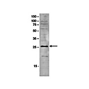 Anti-SAP30 (RABBIT) Antibody, 100µL, Liquid (sterile filtered)