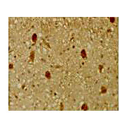 Anti-p130 (Rb2) (RABBIT) Antibody, 100µL, Liquid (sterile filtered)
