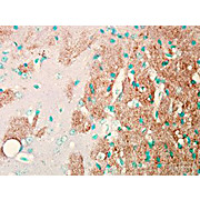 Anti-NAV1.7 (MOUSE) Monoclonal Antibody, 100µg, Liquid (sterile filtered)