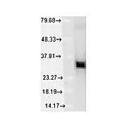 Anti-HO-1 (MOUSE) Monoclonal Antibody, 100µg, Liquid (sterile filtered)