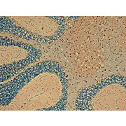 Anti-mSlo maxi- K+ channel (MOUSE) Monoclonal Antibody, 100µg, Liquid (sterile filtered)