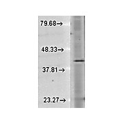Anti-Rhodopsin (MOUSE) Monoclonal Antibody, 100µg, Liquid (sterile filtered)