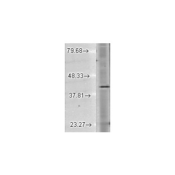 Anti-Rhodopsin (MOUSE) Monoclonal Antibody, 100µg, Liquid (sterile filtered)