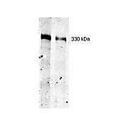 Anti-Thyroglobulin (MOUSE) Monoclonal Antibody, 100µg, Liquid (sterile filtered)