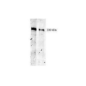 Anti-Thyroglobulin (MOUSE) Monoclonal Antibody, 100µg, Liquid (sterile filtered)