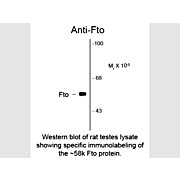 FTO Antibody [5-2H10] 100µL