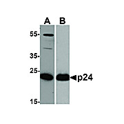 HIV-1 p24 Antibody [7F4] 100µg