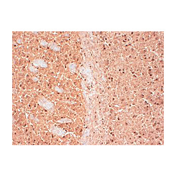 Anti-CASK (MOUSE) Monoclonal Antibody, 100µg, Liquid (sterile filtered)