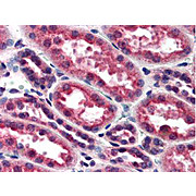 Anti-IKKa (RABBIT) Antibody, 100µL, Liquid (sterile filtered)