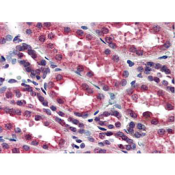 Anti-IKKa (RABBIT) Antibody, 100µL, Liquid (sterile filtered)