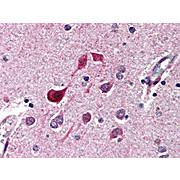 Anti-cdk5 (RABBIT) Antibody, 100µL, Liquid (sterile filtered)
