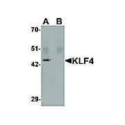 KLF4 Antibody [4G6E11] 100µg