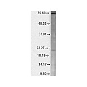 Anti-CAV BETA 2 (MOUSE) Monoclonal Antibody, 100µg, Liquid (sterile filtered)