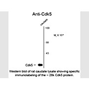 Anti-CDK5 (Mouse) Antibody, 100µL, Liquid