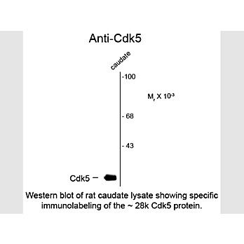 Anti-CDK5 (Mouse) Antibody, 100µL, Liquid