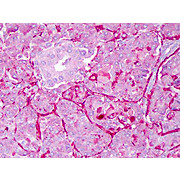Anti-NOTCH 1 (Cleaved N terminal) (Human specific) (RABBIT) Antibody, 200µL, Liquid (sterile filtered)