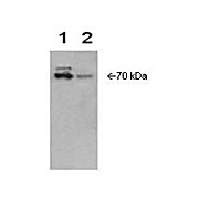 Anti-COX-2 (RABBIT) Antibody, 100µL, Liquid (sterile filtered)