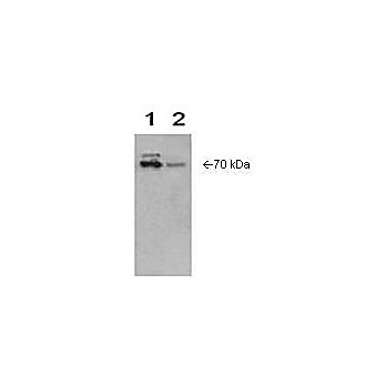 Anti-COX-2 (RABBIT) Antibody, 100µL, Liquid (sterile filtered)