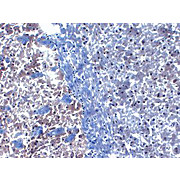 Anti-PICK1 (MOUSE) Monoclonal Antibody, 100µg, Liquid (sterile filtered)