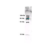 Anti-MYELOPEROXIDASE (Human White Blood Cell) (RABBIT) Antibody, 2mL, Lyophilized