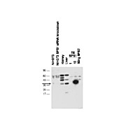 Anti-Selenophosphate Synthetase 1 (SPS1) (RABBIT) Antibody, 100µL, Lyophilized