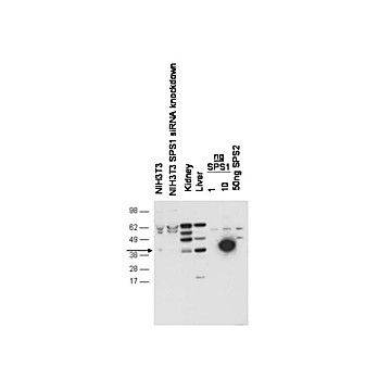 Anti-Selenophosphate Synthetase 1 (SPS1) (RABBIT) Antibody, 100µL, Lyophilized