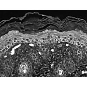 Anti-TRPC7 (MOUSE) Monoclonal Antibody, 100µg, Liquid (sterile filtered)
