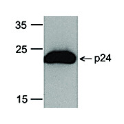 HIV-1 p24 Antibody [8G9] HRP Conj 100µg