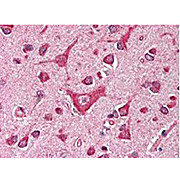 Anti-CaM Kinase IV (RABBIT) Antibody, 100µL, Lyophilized