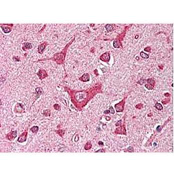 Anti-CaM Kinase IV (RABBIT) Antibody, 100µL, Lyophilized