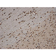 Anti-TrpC5 (MOUSE) Monoclonal Antibody, 100µg, Liquid (sterile filtered)
