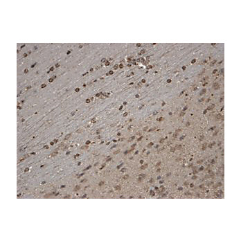 Anti-TrpC5 (MOUSE) Monoclonal Antibody, 100µg, Liquid (sterile filtered)