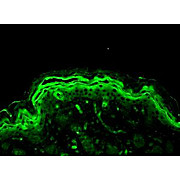 Anti-Erk1/2 (RABBIT) Antibody, 100µL, Liquid (sterile filtered)