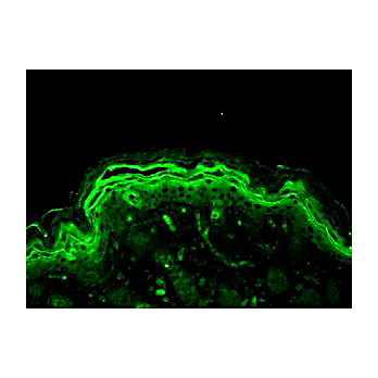Anti-Erk1/2 (RABBIT) Antibody, 100µL, Liquid (sterile filtered)