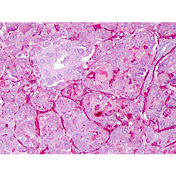 Anti-NOTCH 1 (Cleaved N terminal) (Human specific) (RABBIT) Antibody, 25µL, Liquid (sterile filtered)