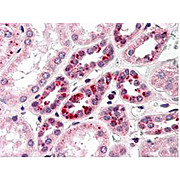 Anti-NOTCH 2 (intra) (Human specific) (RABBIT) Antibody, 200µL, Liquid (sterile filtered)