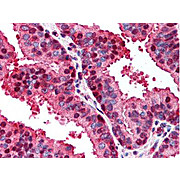 Anti-p16 (RABBIT) Antibody, 100µL, Liquid (sterile filtered)