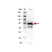 Anti-IKBa C-terminal (RABBIT) Antibody, 100µL, Liquid (sterile filtered)