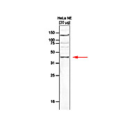 Anti-SETD8 (RABBIT) Antibody, 100µL, Liquid (sterile filtered)