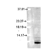 Ubiquitin Antibody [6C11-B3] 200µg