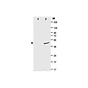 Anti-SUMO (MOUSE) Monoclonal Antibody, 100µg, Liquid (sterile filtered)