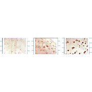 Anti-EC SOD (MOUSE) Monoclonal Antibody, 100µg, Liquid (sterile filtered)