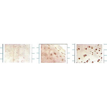 Anti-EC SOD (MOUSE) Monoclonal Antibody, 100µg, Liquid (sterile filtered)