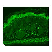 TrpV3 Antibody [S15-4] 100µg