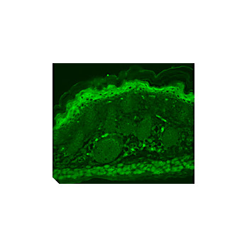 TrpV3 Antibody [S15-4] 100µg